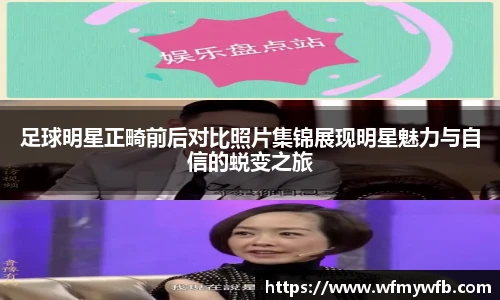 足球明星正畸前后对比照片集锦展现明星魅力与自信的蜕变之旅
